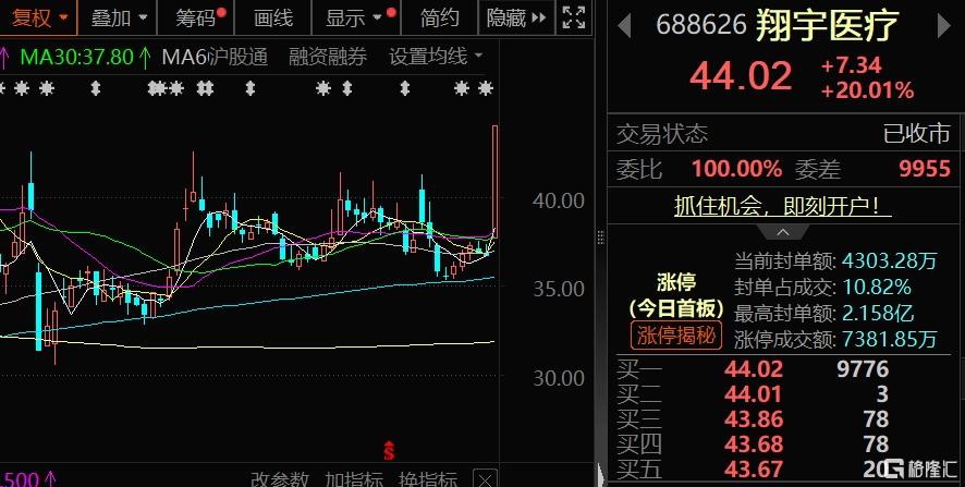 脑机接口2.jpg