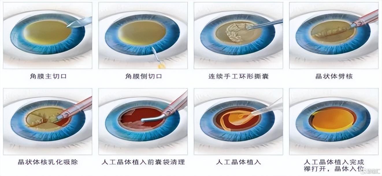 a82e9023-bec4-4170-9c3f-824bc991118d.png